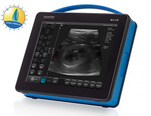 blue ultrasound-scanner